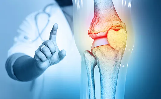 Osteoarthritis