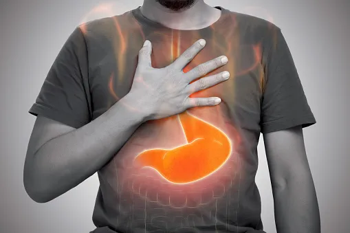 what gets rid of heartburn fast at home